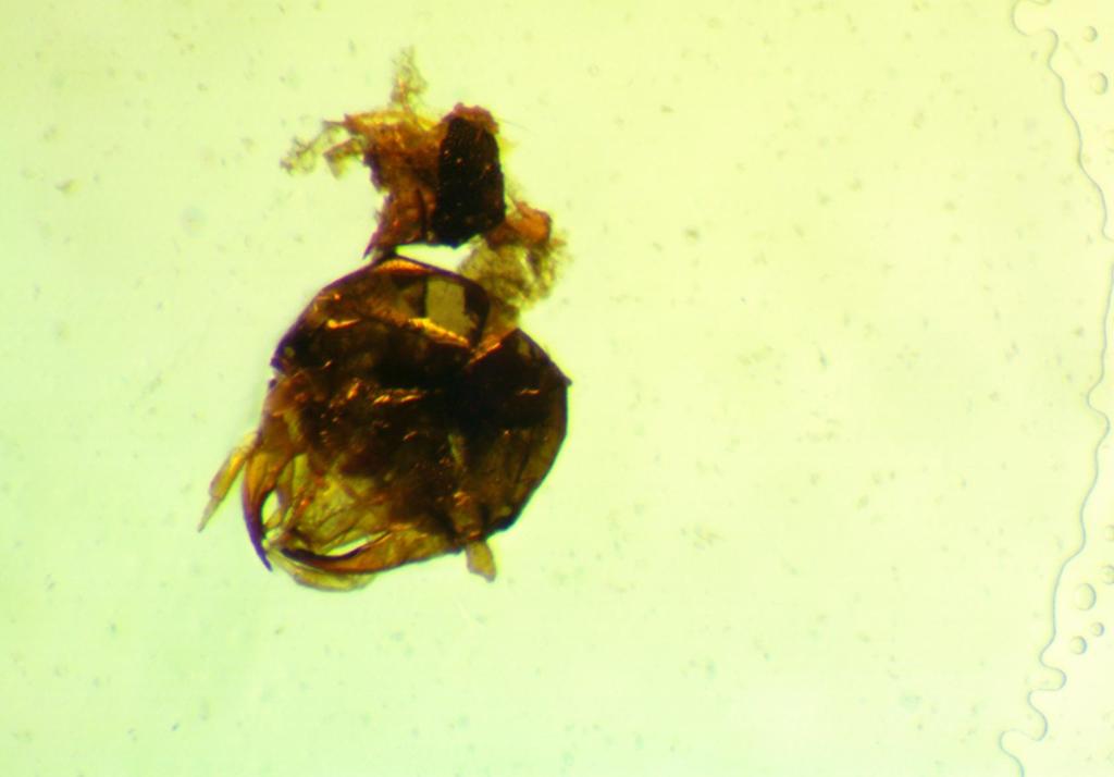 Example of invertebrate fragments identified from Western Snowy Plover fecal samples. A beetle head capsule is shown. (Photo: Elena Oey)