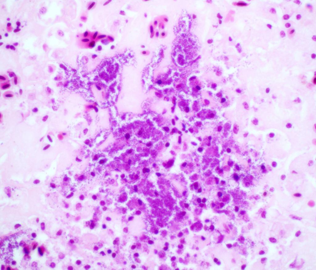 An aggregate of small Gram-negative bacilli in the liver of a wild collared dove. Bacterial culture subsequently identified Pasteurella multocida, which fit with the appearance of these bacteria.