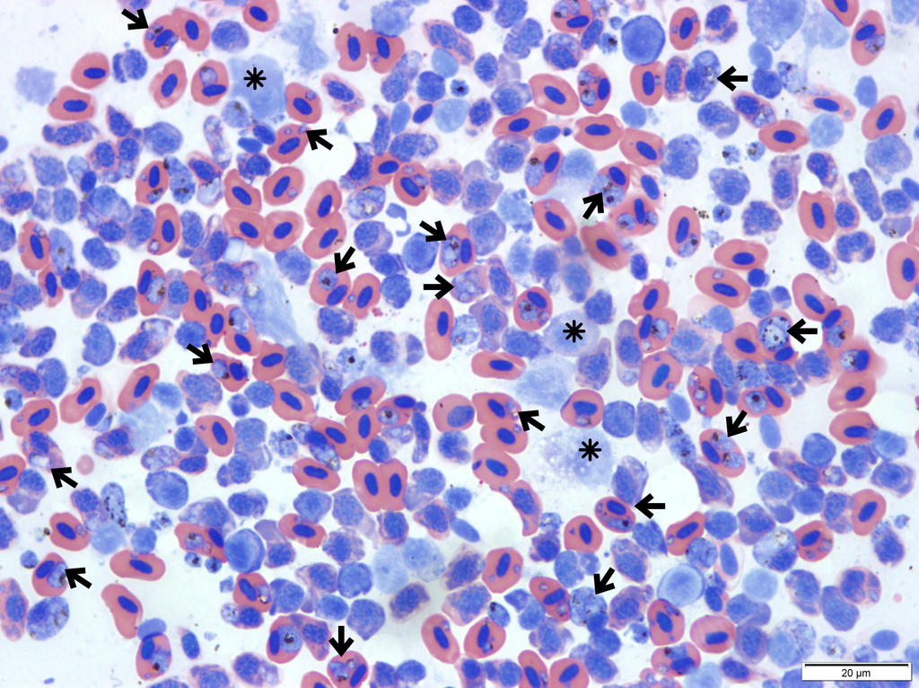 Cytologic preparation of the lung of a kiwikiu examined under a microscope showing round to oval structures (arrows) of different sizes within the cytoplasm of mature and immature red blood cells. The structures are protozoan organisms consistent with the hemoparasite Plasmodium in different stages of development. White blood cells are present as well (asterisk). (Image by Steven Kubiski)