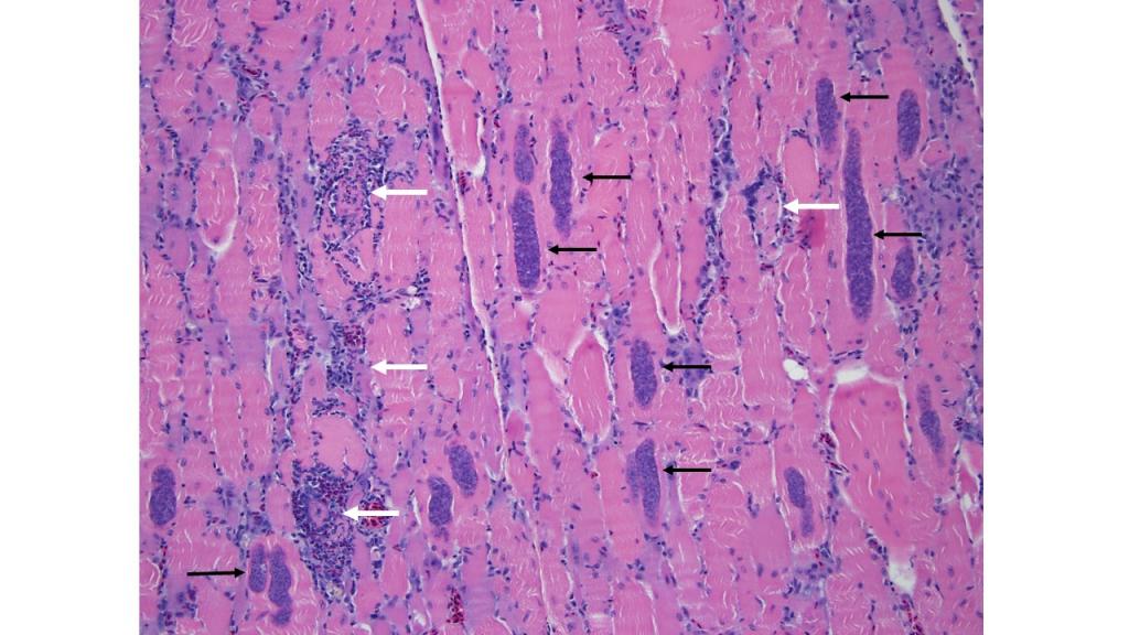 Figure 1. Skeletal muscle with numerous “encysted” Sarcocystis organisms in muscle fibers (black arrows) and several damaged muscle fibers with inflammation (white arrows).