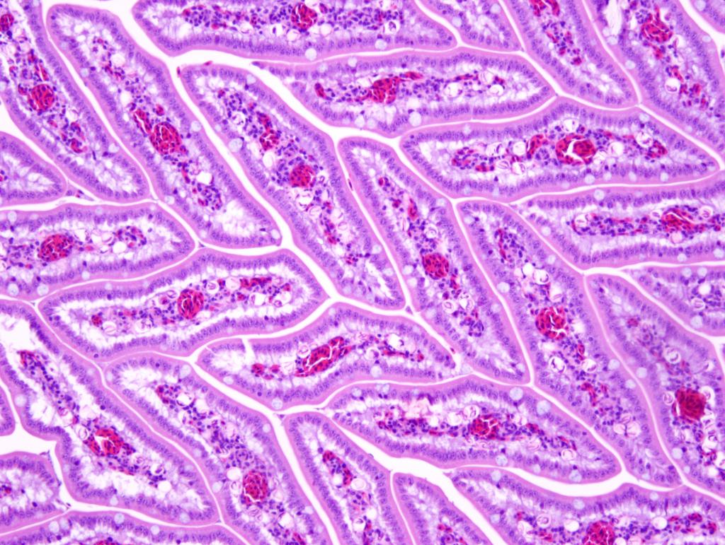 A tangential section of intestinal villi from an owl makes an interesting pattern. Look closely and you might be able to see a coccidian (protozoal parasite) infection.