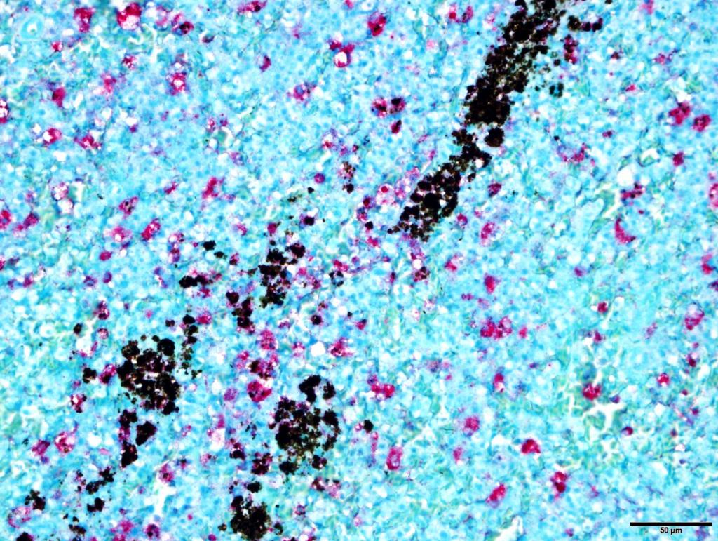 The bright pink spots in this somewhat abstract image are numerous cells of the spleen infected with West Nile virus and detected with a special staining process called immunohistochemistry (IHC). The black pigment is derived from the breakdown of red blood cells and indicates that this crow was also infected with hemoparasites.
