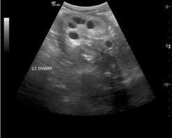 Southern white rhino ovary ultrasound image.
