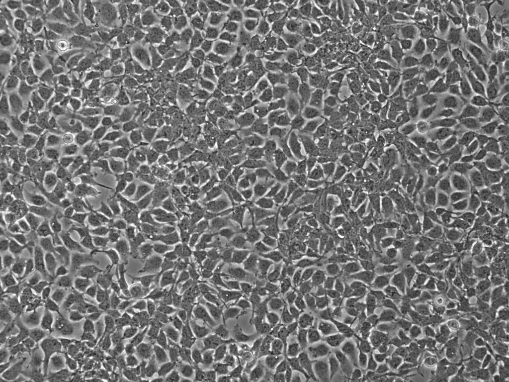 Happy, clean, growing cells. Cells are happy in culture when they are able to reach out to each other and flow continuously on the plate. Small patches of open space are normal, but we know cells are happy when they merge together like they do in this image.