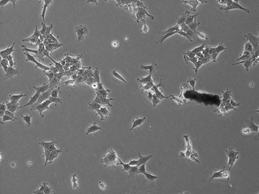 Unhappy, stressed out cells showing signs of contamination. We can tell these cells are not growing properly due to their slow growth in culture and their inability to reach proper confluency in a normal amount of time. Discovery of dark black growths like the one you can see in this image is an abnormal finding and likely a sign of contamination.