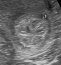 Southern white rhino cross section of uterine horn ultrasound image.