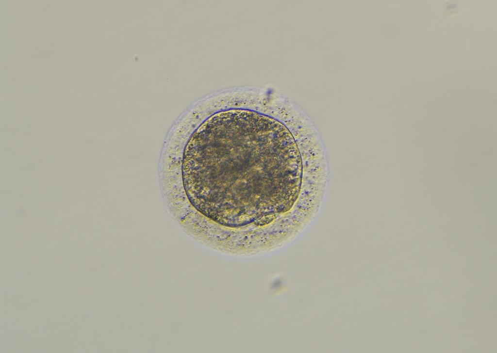 Southern white rhino mature oocyte. Maturation is often achieved in vitro by placing oocytes in maturation medium for a set amount of time. Maturation is indicated by extrusion of a ‘polar body’ (small cell at the 5:30 o’clock position).  This is a necessary step in the in vitro fertilization process and indicates that the oocyte is capable of being fertilized.