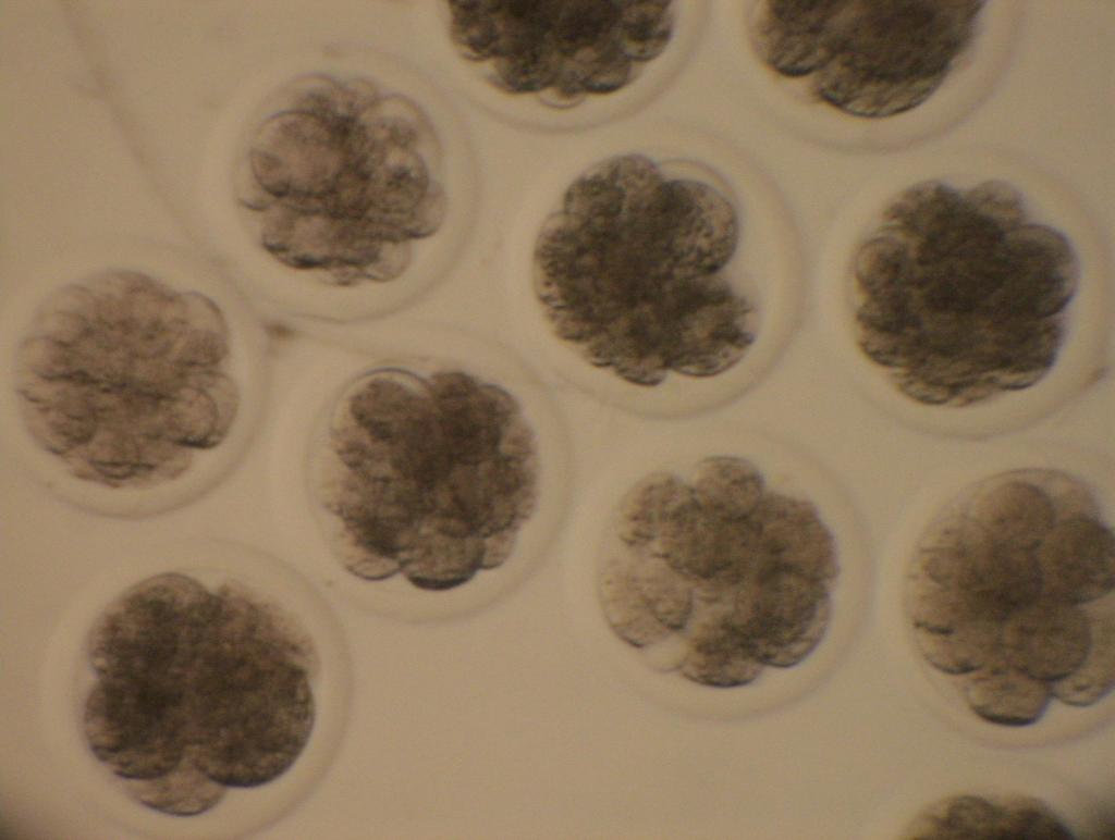 Gemsbok embryos.