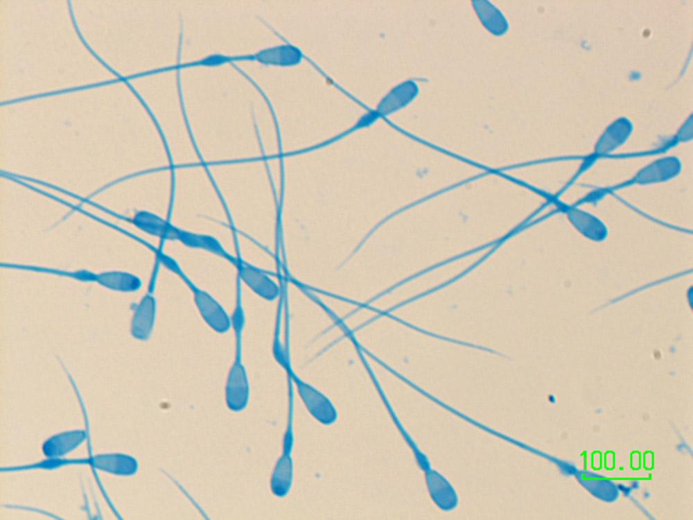 Staining samples of Anglifu’s sperm allowed the author to check its integrity before freezing.