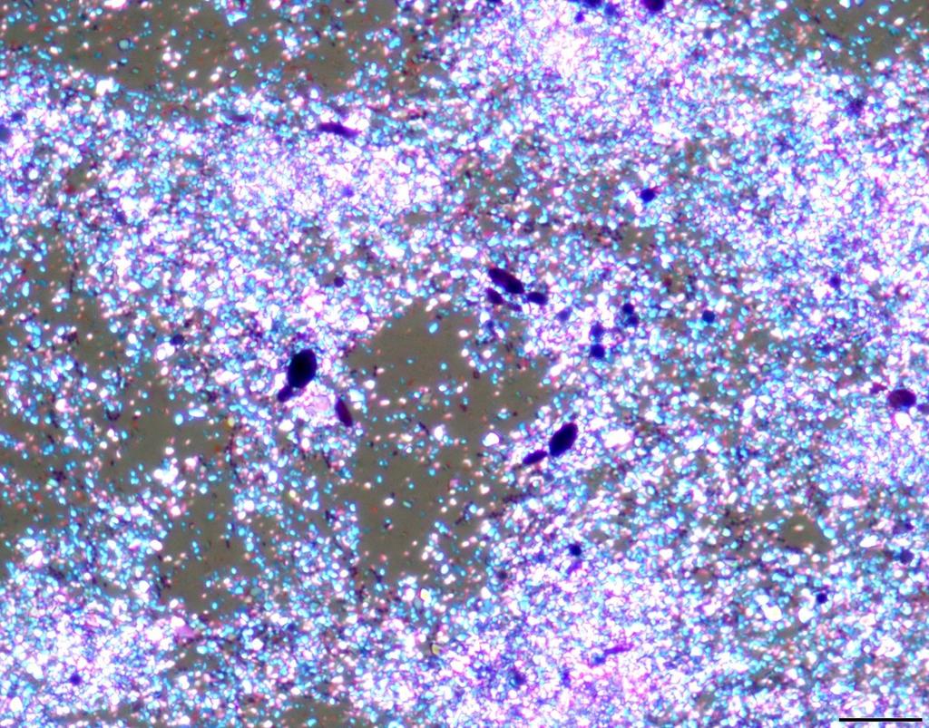 Same preparation viewed under polarized light. Abundant poorly staining granular material in the background is strongly birefringent and likely guanine crystals from the tarantula’s midgut.